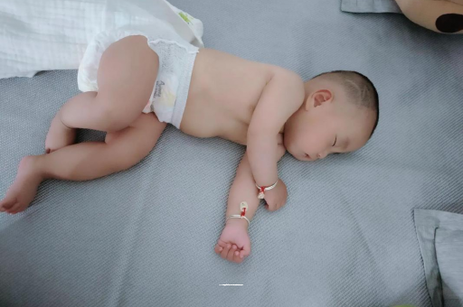 果洛宝宝头上长痱子 果洛宝宝头上长痱子